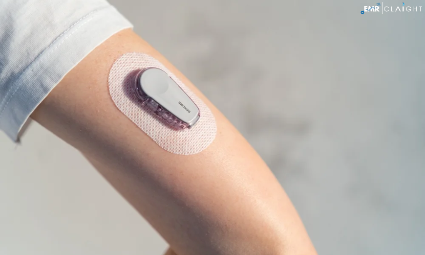 Global Non-Invasive Glucose Monitoring Patent, Trends, Growth, & Future Outlook 2024 – 2032