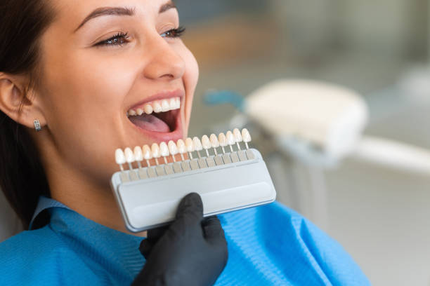 Top Clinics for Teeth Whitening in Riyadh: Reviews & Recommendations