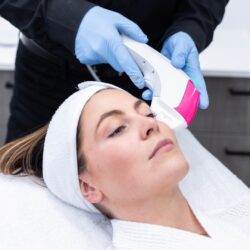 Ultraformer MPT price